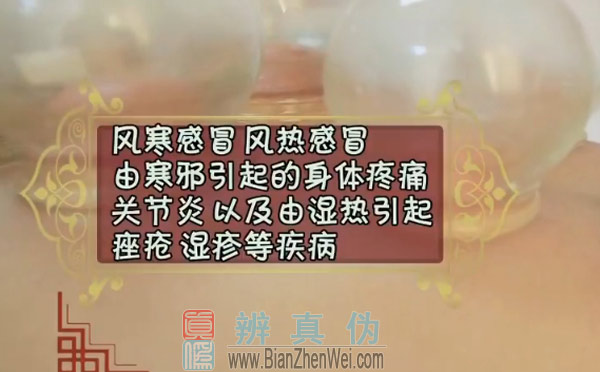 拔罐后罐印颜色越深祛风寒效果越好，拔罐可以治疗风寒感冒、风热感冒，由寒邪引起的身体疼痛，关节炎，以及由湿邪引起的痤疮、湿疹等疾病