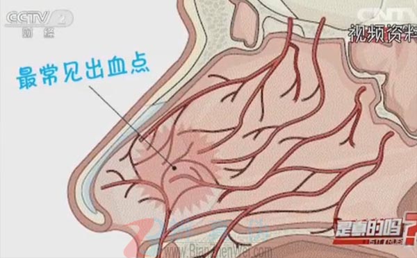 流鼻血时不应该仰头，鼻腔内血管分布密集且敏感——辨真伪网