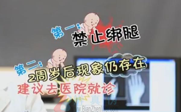 婴儿骨头比成人多99块。禁止绑腿两岁您的孩子还是膝内翻，建议去医院就诊——辨真伪网