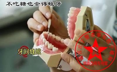 不吃糖也会得蛀牙是真的。平时一定要保持良好的个人卫生习惯,吃完甜食后及时漱口清洁口腔避免蛀牙的发生——辨真伪网 不吃糖也会得蛀牙是真的。平时一定要保持良好的个人卫生习惯,吃完甜食后及时漱口清洁口腔避免蛀牙的发生——辨真伪网