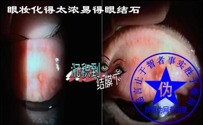 眼妆化得太浓易得眼结石是网络谣言——辨真伪网 眼妆化得太浓易得眼结石是网络谣言——辨真伪网
