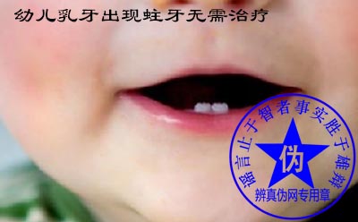 幼儿乳牙出现蛀牙无需治疗是网络谣言——辨真伪网